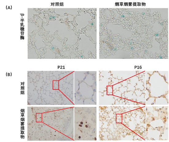 (Zhang, et al. 2021 |Free Radical Biology and Medicine) 烟草烟雾诱发小鼠肺组织中的衰老细胞增加。（A）图中对肺组织进行β-半乳糖苷酶染色，蓝色细胞为衰老细胞。（B）图显示了细胞衰老标志物p21和p16染色的肺组织。在这两种情况下，暴露于烟草烟雾的肺组织比未经处理的对照组的染色更多，提示烟草烟雾促进肺细胞衰老。