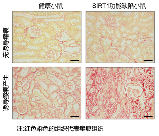 图3：SIRT1功能缺陷可加重肾组织瘢痕
