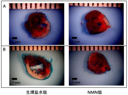 图5: 罗格斯大学研究显示NMN可帮助降低缺血对小鼠心脏造成的严重损伤