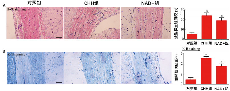 图5 补充NAD+前体对小鼠大脑白质的影响注：(A)：通过H&E染色确定的液泡样空腔的面积（比例尺=100μm），紫色代表细胞核，粉色代表其他细胞内物质，无色透明空腔即为白质液泡样病变；（B）：通过K-B染色检测髓鞘的丢失程度（比例尺=100μm），髓鞘纤维浅呈蓝色，神经细胞呈深蓝色。*代表以对照组为参照时，p < 0.05，#代表以CCH组为参照时，p < 0.05。(Liu et al, 2021 | Frontiers in Neurology ) 