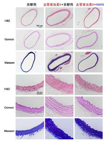 图5. 小鼠的胸主动脉切片显示，NMN使得血管的中膜厚度、中膜与管腔比值、胶原蛋白沉积减少。以上血管切片代表性图像分别用H&E染色、Gomori醛品红染色（亮紫色代表弹性蛋白）和Masson三色蓝染色（蓝色代表胶原沉积）。