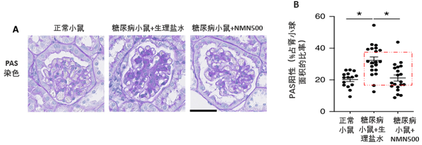 日本庆应大学研究发现NMN或可预防糖尿病肾病插图5NMN 日本庆应大学研究发现NMN或可预防糖尿病肾病插图5NMN