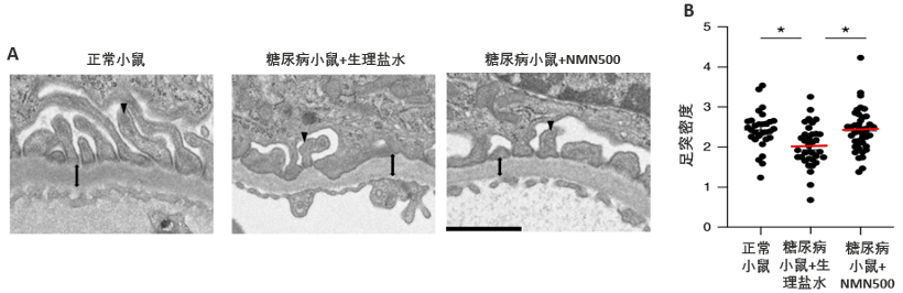 日本庆应大学研究发现NMN或可预防糖尿病肾病插图6NMN 日本庆应大学研究发现NMN或可预防糖尿病肾病插图6NMN