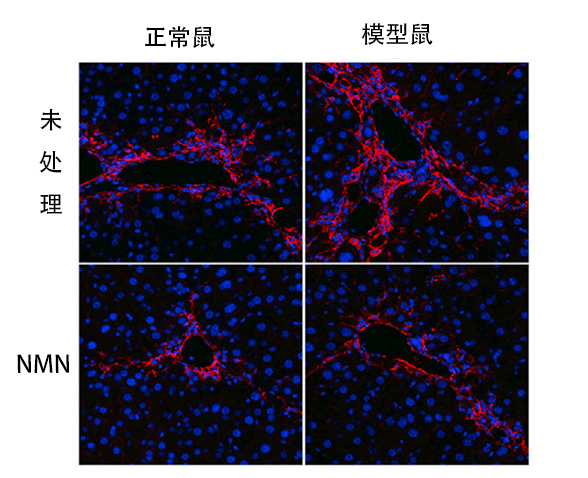 图2 模型鼠和正常小鼠的肝纤维化对比红色信号代表肝纤维化情况；相比未处理，NMN可使红色信号减弱