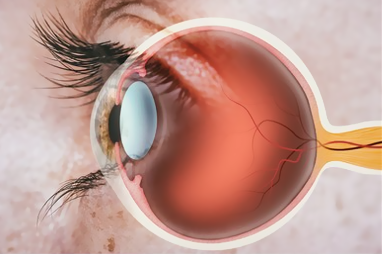 《国际老年病学与老年学》：补充NMN可降低视网膜病变发生率